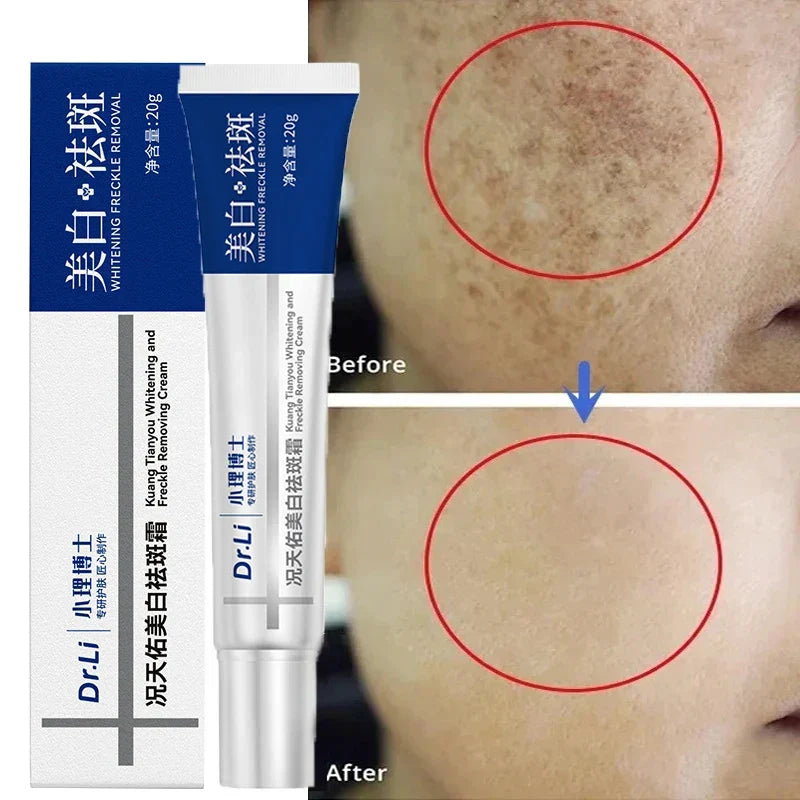 NNEOBA Whitening Freckles Cream - Korean Skincare